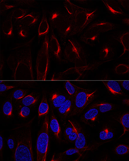Vimentin Rabbit pAb