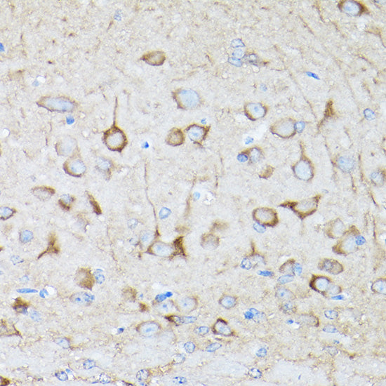 DRP1 Rabbit pAb
