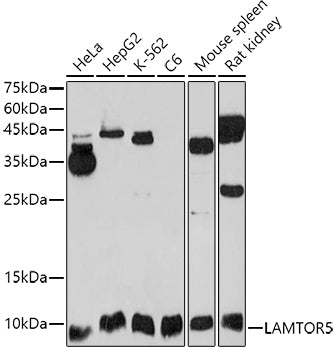 LAMTOR5 Rabbit pAb