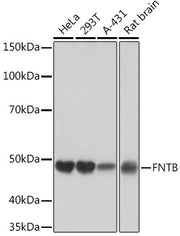 FNTB Rabbit mAb