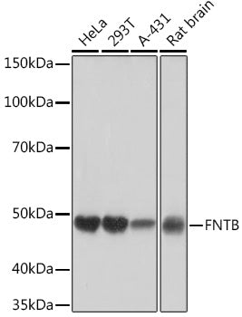 FNTB Rabbit mAb