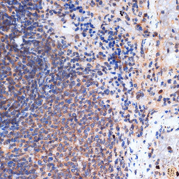 FNTB Rabbit mAb