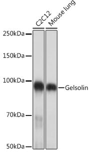 Gelsolin Rabbit mAb