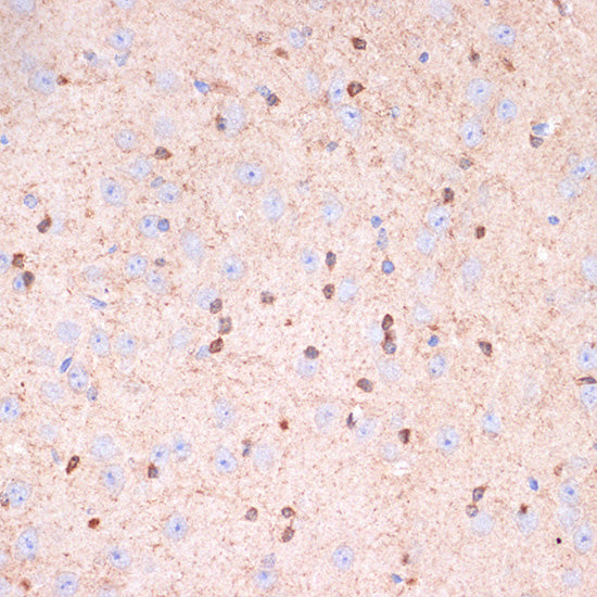 Gelsolin Rabbit mAb