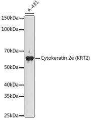 Cytokeratin 2e (KRT2) Rabbit mAb