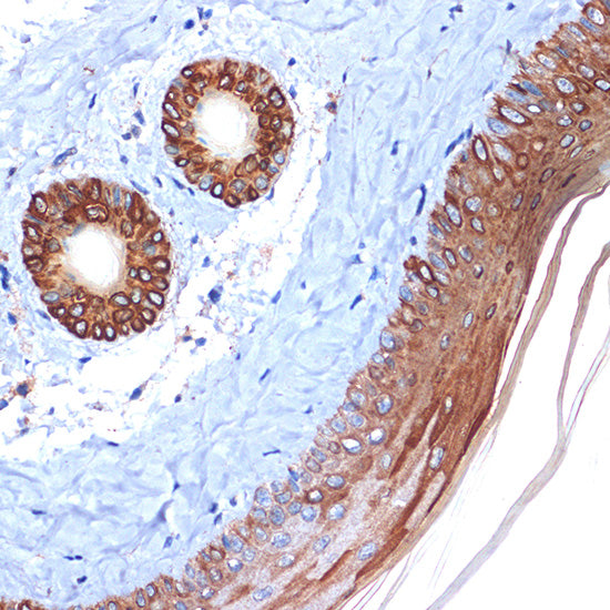 Cytokeratin 2e (KRT2) Rabbit mAb