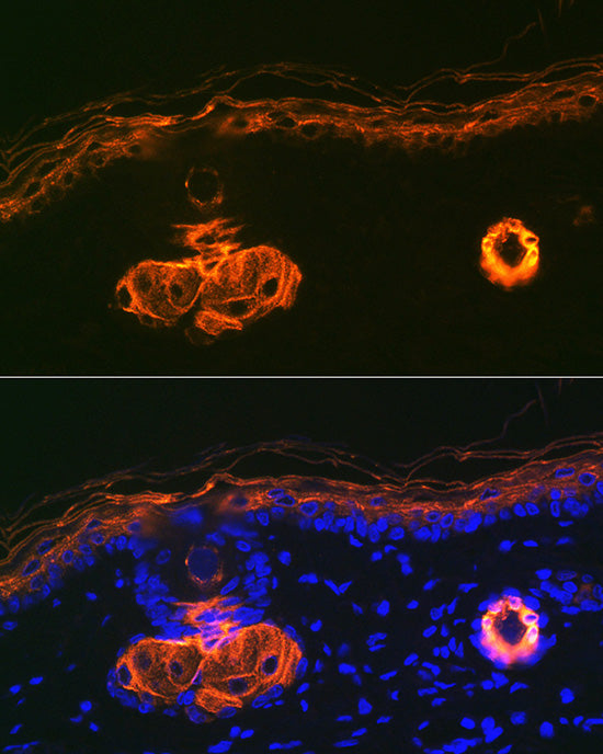 Cytokeratin 2e (KRT2) Rabbit mAb