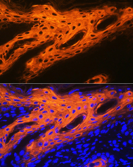 Cytokeratin 2e (KRT2) Rabbit mAb