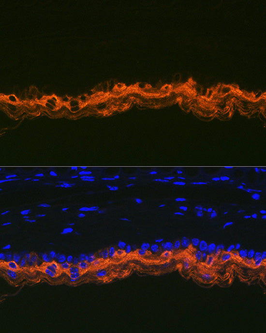 Cytokeratin 2e (KRT2) Rabbit mAb