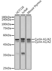 Cyclin A1/A2 Rabbit mAb