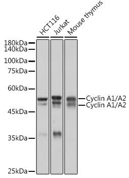 Cyclin A1/A2 Rabbit mAb