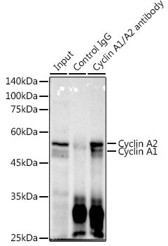 Cyclin A1/A2 Rabbit mAb