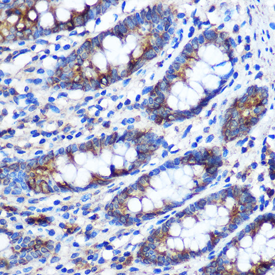 STAT4 Rabbit pAb