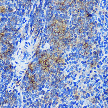 STAT4 Rabbit pAb