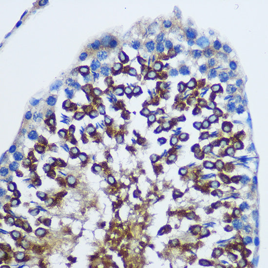 STAT4 Rabbit pAb