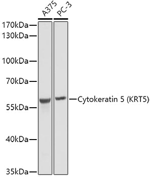 Cytokeratin 5 Rabbit pAb