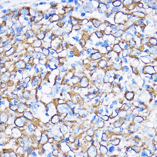 Cytokeratin 5 Rabbit pAb