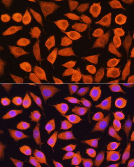 Cytokeratin 5 Rabbit pAb