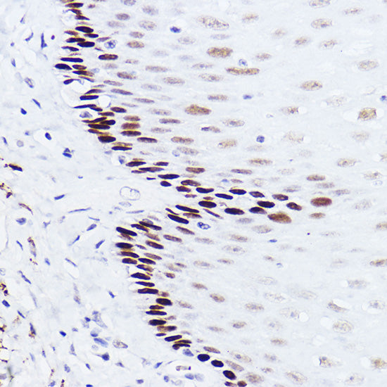 p73 Rabbit mAb