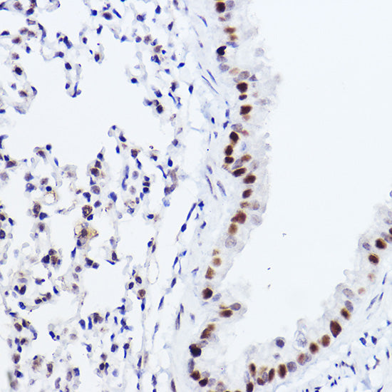 p73 Rabbit mAb