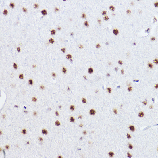 p73 Rabbit mAb