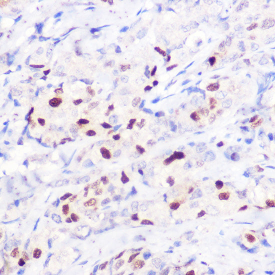 CDKN1A/p21CIP1 Rabbit pAb