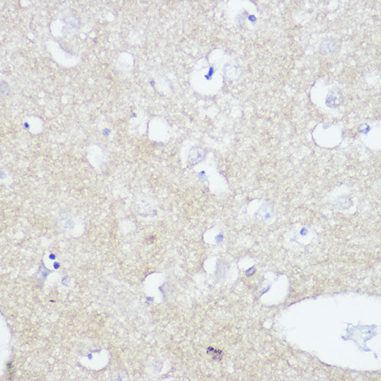 TrkA+B+C Rabbit mAb