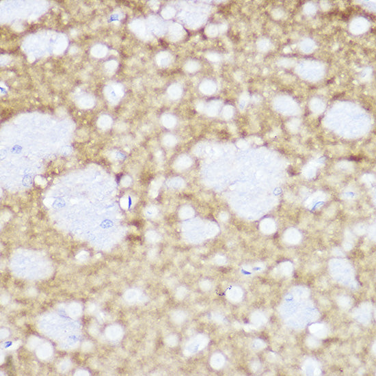 TrkA+B+C Rabbit mAb