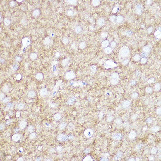 TrkA+B+C Rabbit mAb