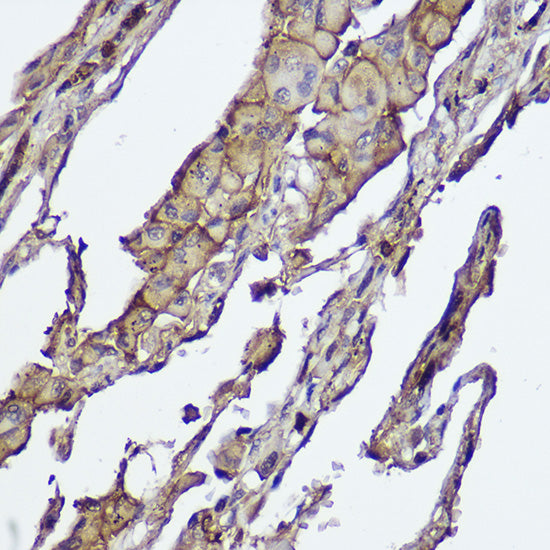 AKT1/2 Rabbit mAb