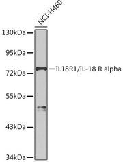 IL18R1/IL-18 R alpha Rabbit pAb