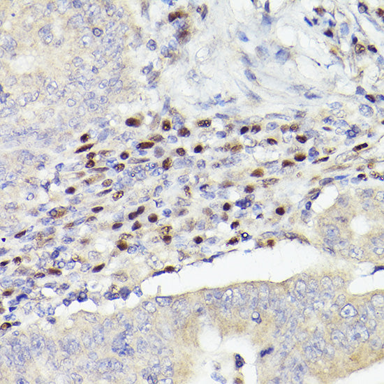 MEF2A+MEF2C Rabbit mAb