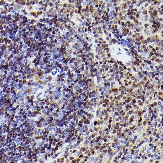 MEF2A+MEF2C Rabbit mAb