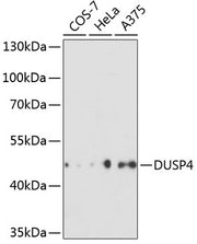 DUSP4 Rabbit pAb