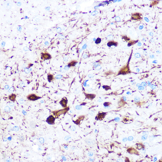 gamma-Synuclein Rabbit mAb