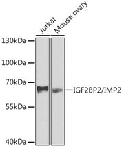 IGF2BP2/IMP2 Rabbit pAb