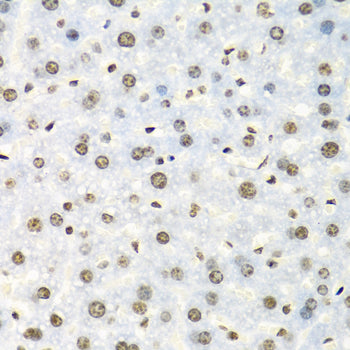 IGF2BP2/IMP2 Rabbit pAb