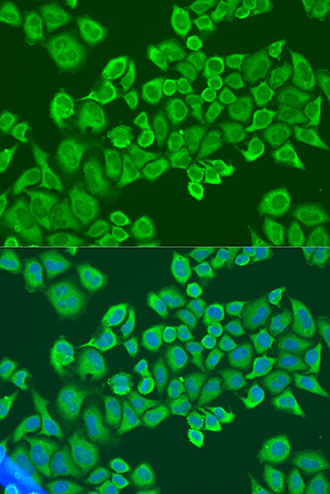 IGF2BP2/IMP2 Rabbit pAb