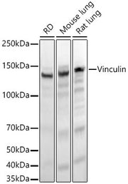 Vinculin Rabbit mAb