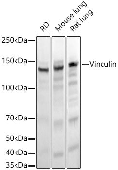 Vinculin Rabbit mAb