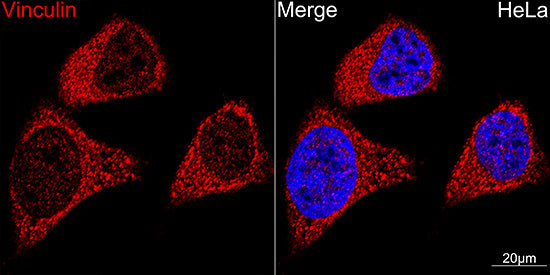 Vinculin Rabbit mAb