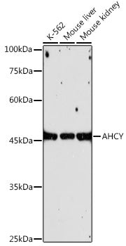 AHCY Rabbit mAb