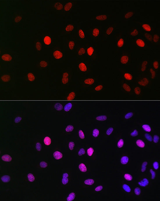 Acetyl-Histone H3-K23 Rabbit mAb