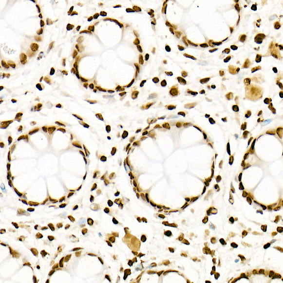 Acetyl-Histone H3-K27 Rabbit mAb