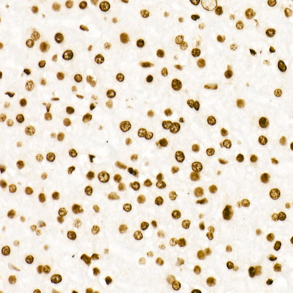 Acetyl-Histone H3-K27 Rabbit mAb
