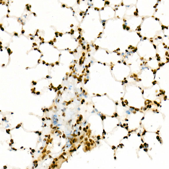 Acetyl-Histone H3-K27 Rabbit mAb