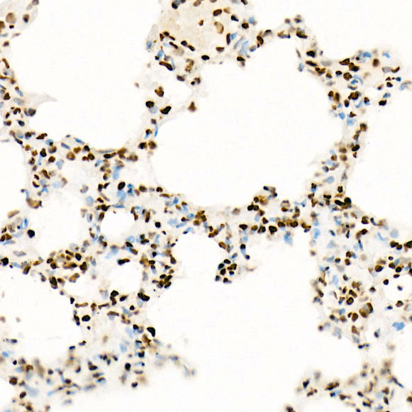 Acetyl-Histone H3-K27 Rabbit mAb