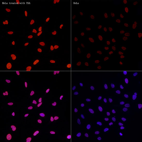 Acetyl-Histone H3-K27 Rabbit mAb