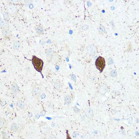Parvalbumin/PVALB Rabbit pAb
