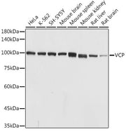 VCP Rabbit pAb